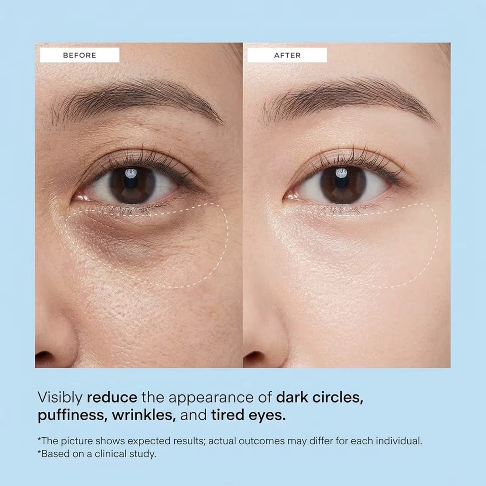 Caffeine & Hyaluronic Acid Eye Gel Patch
